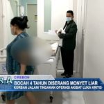Bocah 4 Tahun Diserang Monyet Liar