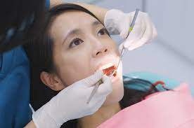 Mengatasi Gigi Berlubang Langkah-Langkah Perawatan yang Efektif