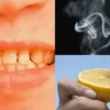 penyebab gigi kuning