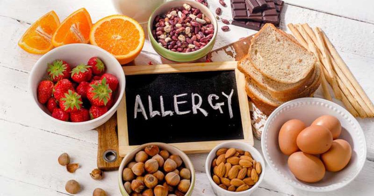 Apa Itu Alergi Makanan dan Apa Saja Makanan yang Menyebabkan Alergi? Simak Info Selengkapnya