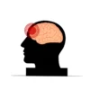 Titik Sakit Kepala dan Penyebabnya